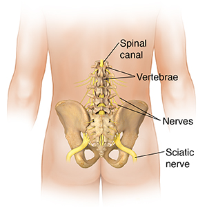 Sciatic Pain Associated with Lumbar Disc Conditions