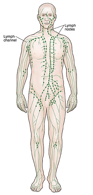 Why do my lymph nodes swell?