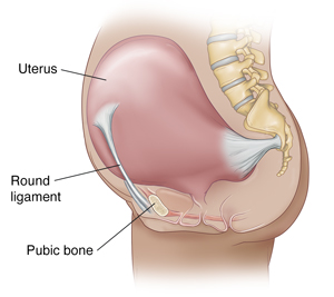 Round Ligament Pain