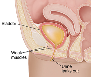 10 truths: leaking urine in pregnancy and after birth