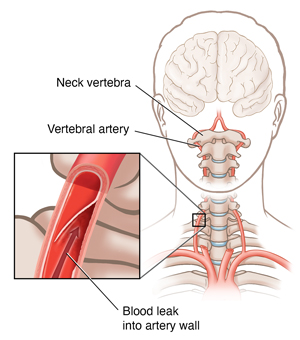 front of neck Diagram