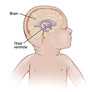 Side view of baby's head showing normal ventricles in brain.