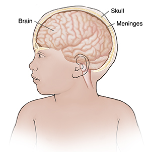 Front view of child with head turned showing brain and meninges.