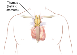 Thymoma and Thymic Carcinoma | Saint Luke's Health System