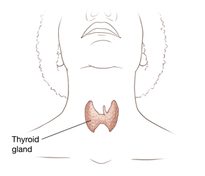 Schematic drawing showing the operative technique chosen for patients