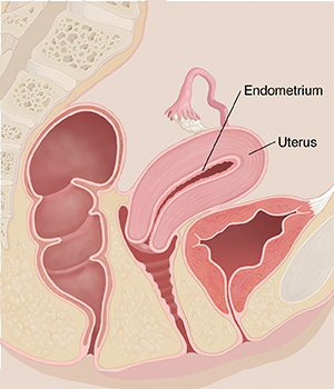 Side view cross section of woman's pelvis showing uterus and lining of uterus.