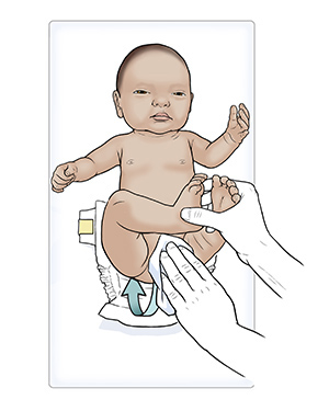 Diapering Your Newborn, Patient Education