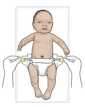 Changing Newborn Diapers: Umbilical Cord Care