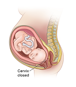 Understanding Preterm Labor Saint Luke s Health System