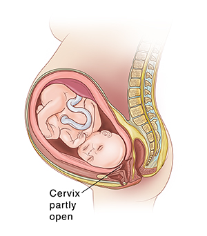 Understanding Preterm Labor Saint Luke s Health System