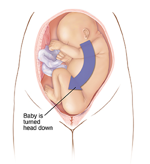 Cephalic Position: Understanding Your Baby's Presentation at Birth