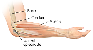 Forearm deals muscle strain