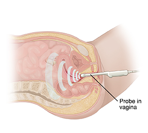 Check up  Transducer Probe Cover For Vaginal Ultrasound