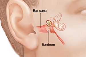 Ruptured Eardrum  Saint Luke's Health System