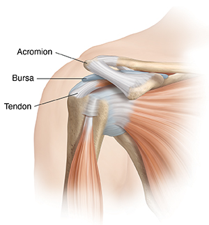 Shoulder Pain? Could It Be Shoulder Impingement Syndrome?