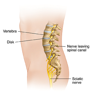 Possible Causes of Low Back or Leg Pain