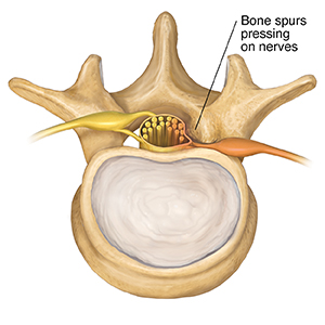 Possible Causes Of Low Back Or Leg Pain 