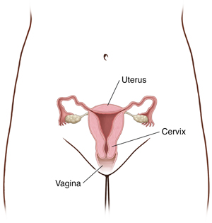 Understanding Cervical Biopsy