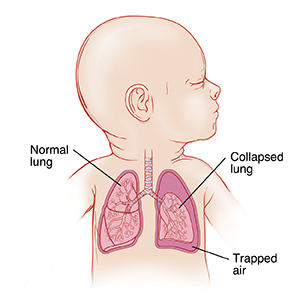 Lung - Pocket Anatomy