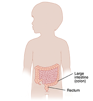 6 year old boy, white stains in underwear