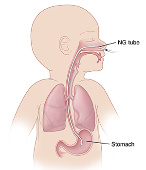 https://api.kramesstaywell.com/Content/6066ca30-310a-4170-b001-a4ab013d61fd/medical-illustrations/Images/88659_1