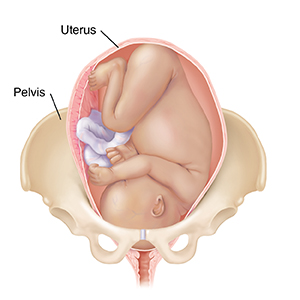 All the Effects of Birth on the Pelvis - Institute for Birth Healing Courses