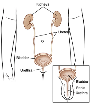 Pregnancy and urinary tract infections (UTIs).