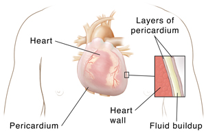 Side view of the male chest showing the different layers it contains