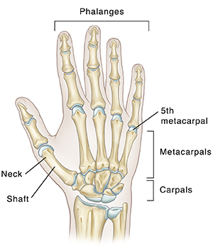 Boxer s Fracture Saint Luke s Health System