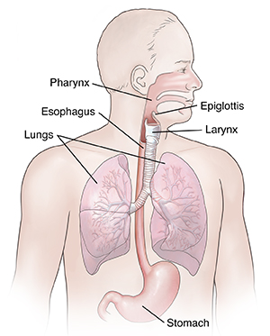 Understanding Aspiration from Dysphagia