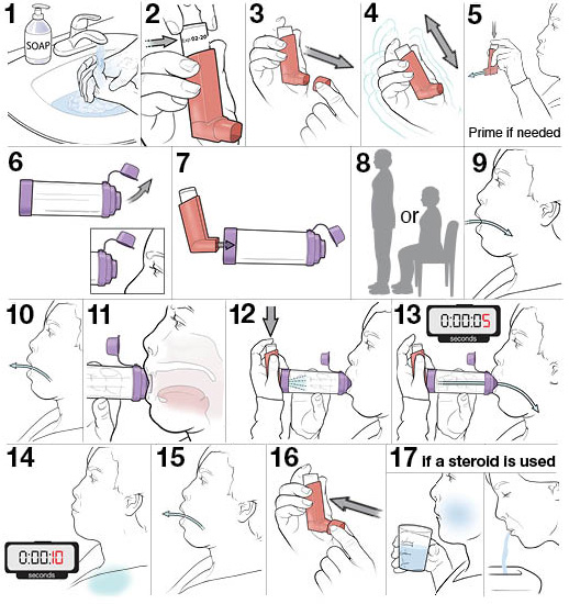 17 steps for using an MDI with a spacer
