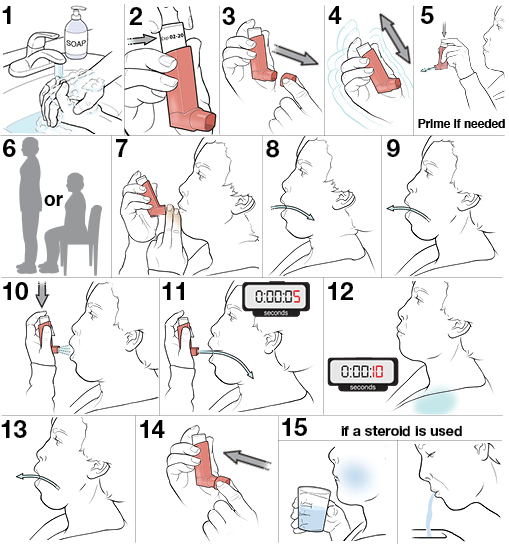 15 steps for using a Metered Dose Inhaler Without a Spacer