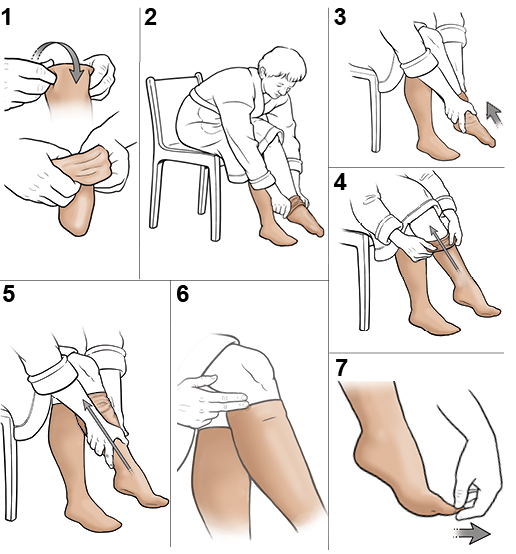 Step-by-Step: Putting on Knee-High Compression Stockings