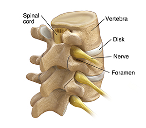 Understanding Foraminotomy | Saint Luke's Health System