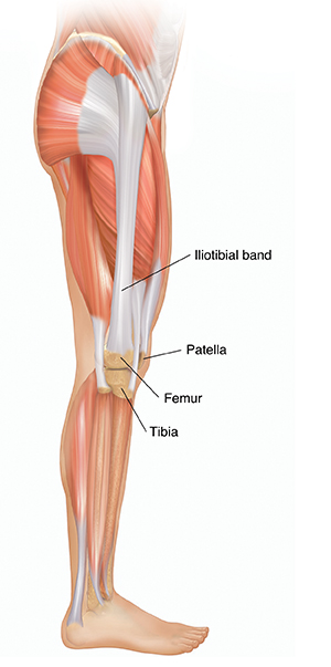 What Is Iliotibial Band Syndrome? Symptoms, Causes & Treatment