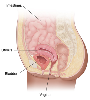 Robotic Assisted Sacrocolpopexy of Uterine and Vaginal Prolapse