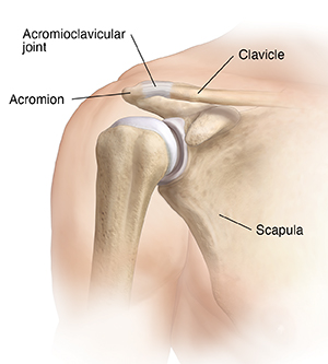 Understanding AC Joint Sprain