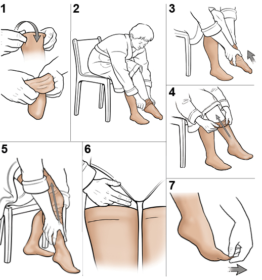 How to Put on Compression Stockings (with Pictures) - wikiHow