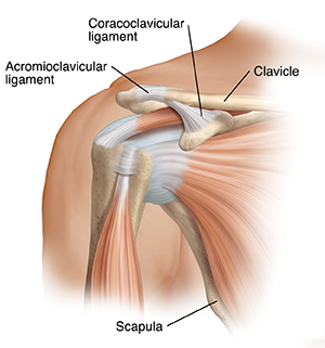 Shoulder Separation  AC Joint Injury Symptoms & Repair