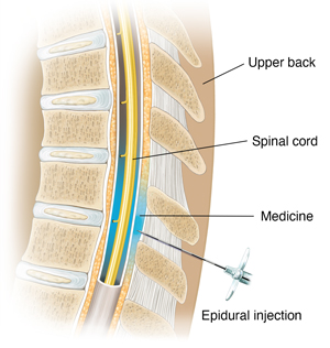 How Your Back Works  Saint Luke's Health System