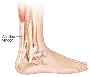 Side achilles sale tendon pain