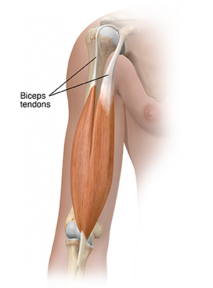 Bicep on sale tendonitis symptoms