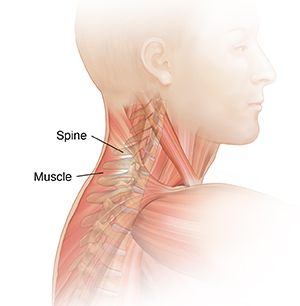 What Causes Front Neck Muscle Pain?, Treatment