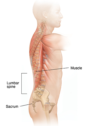 Back Muscle Pain Relief and Severe Lower Back Strain