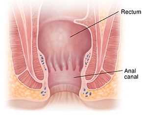 Understanding Anal Stricture Saint Luke s Health System