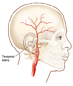 Bone Biopsy  Saint Luke's Health System