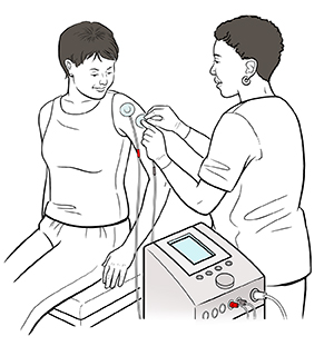 Transcutaneous Electrical Nerve Stimulation (TENS).