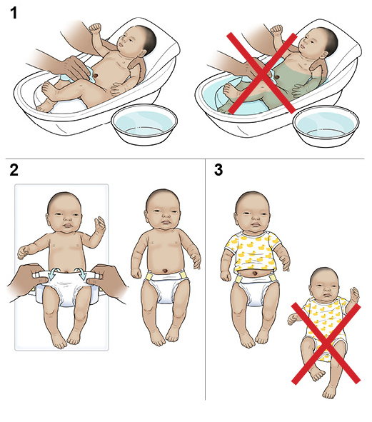 Step-by-Step: Caring for Your Newborn's Umbilical Cord