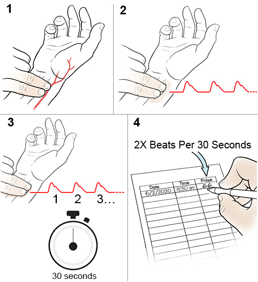 Taking Your Pulse at Your Wrist | Saint Luke's Health System