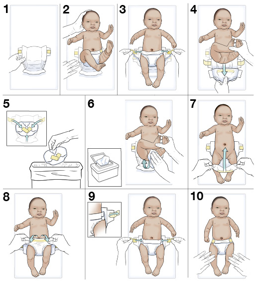 Tricks For Changing a Baby Boy's Diaper